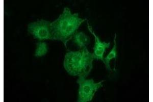 Anti-MTMR14 mouse monoclonal antibody (ABIN2453860) immunofluorescent staining of COS7 cells transiently transfected by pCMV6-ENTRY MTMR14 (RC207732). (MTMR14 antibody)