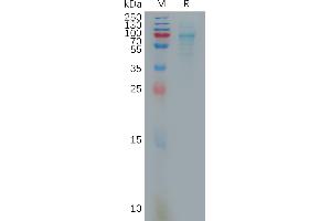 Chemokine (C-X-C Motif) Ligand 16 (CXCL16) protein (Fc Tag)
