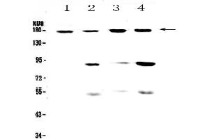 Western blot analysis of CD11b using anti-CD11b antibody .