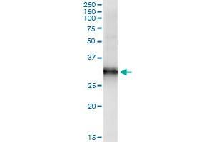 Immunoprecipitation of HOXB9 transfected lysate using anti-HOXB9 monoclonal antibody and Protein A Magnetic Bead , and immunoblotted with HOXB9 MaxPab rabbit polyclonal antibody. (HOXB9 antibody  (AA 65-163))