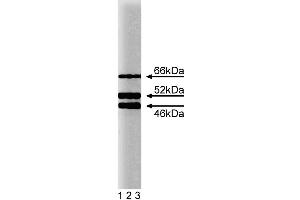 Western blot analysis of SHC on a HeLa cell lysate (Human cervical epitheloid carcinoma, ATCC CCL-2. (SHC1 antibody  (AA 359-473))