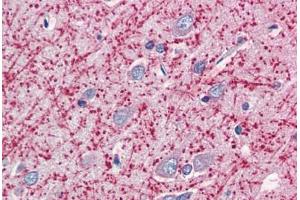 Human Brain, Cortex (formalin-fixed, paraffin-embedded) stained with MOG antibody ABIN337146 at 5 ug/ml followed by biotinylated anti-goat IgG secondary antibody ABIN481715, alkaline phosphatase-streptavidin and chromogen. (MOG antibody  (AA 248-259))