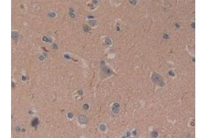 Detection of CYLD in Human Brain Tissue using Polyclonal Antibody to Cylindromatosis (CYLD) (CYLD antibody  (AA 170-338))