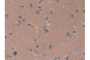 Detection of CYLD in Human Brain Tissue using Polyclonal Antibody to Cylindromatosis (CYLD)