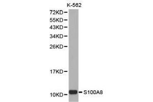 Western Blotting (WB) image for anti-S100 Calcium Binding Protein A8 (S100A8) antibody (ABIN1874685) (S100A8 antibody)
