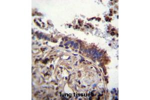 TTBK2 Antibody (N-term) immunohistochemistry analysis in formalin fixed and paraffin embedded human lung tissue followed by peroxidase conjugation of the secondary antibody and DAB staining. (TTBK2 antibody  (N-Term))