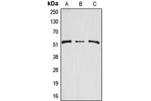 Western blot analysis of Arylsulfatase A expression in HEK293T (A), mouse kidney (B), rat kidney (C) whole cell lysates.