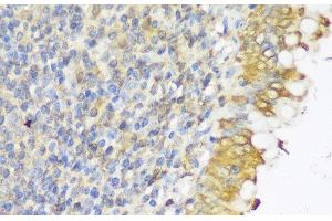Immunohistochemistry of paraffin-embedded Human appendix using GLB1L3 Polyclonal Antibody at dilution of 1:150 (40x lens). (GLB1L3 antibody)