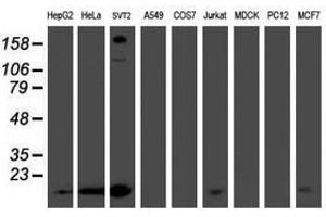 Image no. 1 for anti-Phosphomevalonate Kinase (PMVK) antibody (ABIN1500303) (PMVK antibody)