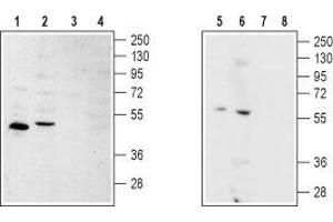 Western blot analysis of rat kidney (lanes 1 and 3), rat heart (lanes 2 and 4), human SH-SY5Y brain neuroblastoma (lanes 5 and 7) and Human MS-1  neuroendocrine skin carcinoma cell (lanes 6 and 8) lysates: - 1,2,5,6. (S1PR2 antibody  (2nd Cytoplasmic Loop))