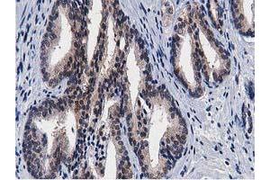 Image no. 4 for anti-Transforming, Acidic Coiled-Coil Containing Protein 3 (TACC3) antibody (ABIN1498095) (TACC3 antibody)