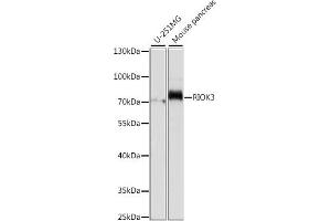Western blot analysis of extracts of various cell lines, using RIOK3 antibody (ABIN7270112) at 1:1000 dilution. (RIOK3 antibody  (AA 200-519))