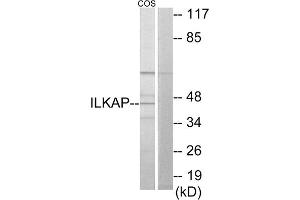 Western blot analysis of extracts from COS-7 cells, using ILKAP antibody. (ILKAP antibody  (Internal Region))