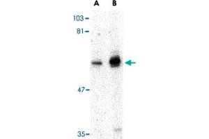 Western blot analysis of PTPN11 in mouse skeletal muscle tissue lysate with PTPN11 polyclonal antibody  at (A) 0. (PTPN11 antibody  (N-Term))