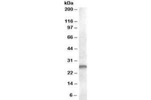 Western blot testing of human kidney lysate with CLEC1B antibody at 1ug/ml. (C-Type Lectin Domain Family 1, Member B (CLEC1B) antibody)