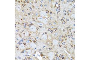 Immunohistochemistry (Paraffin-embedded Sections) (IHC (p)) image for anti-Actin-Related Protein 2 (ACTR2) (AA 1-160) antibody (ABIN6136493)