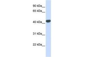 Image no. 1 for anti-Zinc Finger Protein 265 (Zranb2) (AA 72-121) antibody (ABIN6740510) (ZNF265 antibody  (AA 72-121))