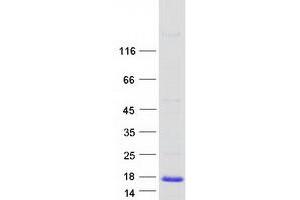 Validation with Western Blot (Microseminoprotein, Prostate Associated (MSMP) protein (Myc-DYKDDDDK Tag))