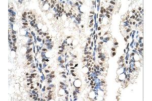 RUNDC2A antibody was used for immunohistochemistry at a concentration of 4-8 ug/ml.