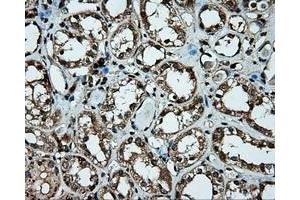 Immunohistochemical staining of paraffin-embedded liver tissue using anti-PLEK mouse monoclonal antibody.