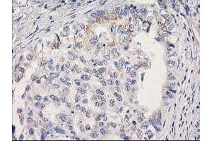 Image no. 1 for anti-Mitochondrial Ribosomal Protein S2 (MRPS2) antibody (ABIN1499562) (MRPS2 antibody)