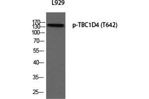 Western Blotting (WB) image for anti-TBC1 Domain Family, Member 4 (TBC1D4) (pThr642) antibody (ABIN5955761)