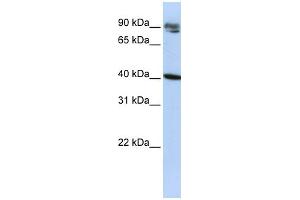 WB Suggested Anti-KLHDC8A Antibody Titration:  0. (KLHDC8A antibody  (Middle Region))