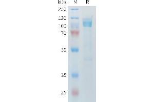 Mouse Protein, His Tag on SDS-PAGE under reducing condition.
