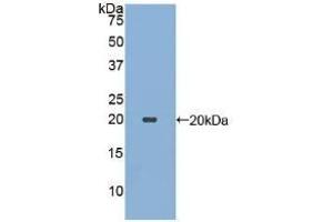 Detection of Recombinant ECP, Human using Polyclonal Antibody to Ecotin (ECO) (Ecotin (AA 21-162) antibody)