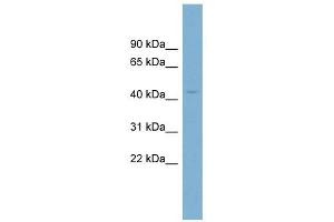 CRBN antibody used at 1 ug/ml to detect target protein. (CRBN antibody  (N-Term))