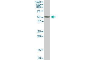 HDAC3 monoclonal antibody (M02), clone 3E11. (HDAC3 antibody  (AA 319-428))