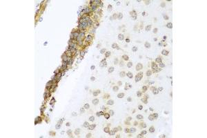 Immunohistochemistry of paraffin-embedded mouse brain using YBX1 antibody. (YBX1 antibody)