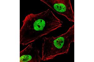 Immunofluorescent analysis of 4 % paraformaldehyde-fixed, 0. (BCL9 antibody  (AA 272-304))