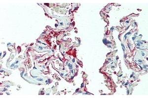 Detection of CXCL2 in Human Lung Tissue using Polyclonal Antibody to Chemokine (C-X-C Motif) Ligand 2 (CXCL2) (CXCL2 antibody  (AA 34-107))