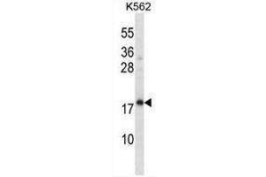 CREG1 Antibody (N-term) western blot analysis in K562 cell line lysates (35µg/lane).
