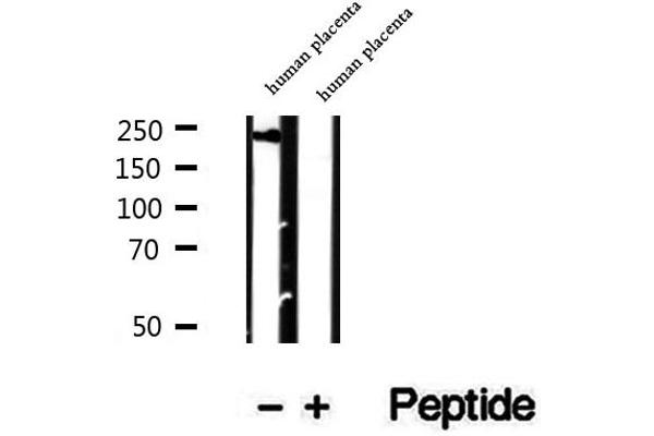 PRPF8 Antikörper  (C-Term)