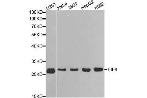 Western blot analysis of extracts of various cell lines, using EIF6 antibody. (EIF6 antibody)