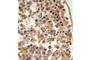 Formalin fixed and paraffin embedded testis tissue reacted with FANCC Antibody (C-term) followed by peroxidase conjugation of the secondary antibody and DAB staining. (FANCC antibody  (C-Term))