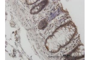 Immunoperoxidase of monoclonal antibody to GCN5L2 on formalin-fixed paraffin-embedded human colon. (KAT2A antibody  (AA 738-837))