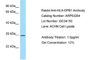 Western Blotting (WB) image for anti-Major Histocompatibility Complex, Class II, DP beta 1 (HLA-DPB1) (Middle Region) antibody (ABIN2789429) (HLA-DPB1 antibody  (Middle Region))