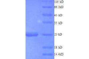 SDS-PAGE (SDS) image for Histone Deacetylase 7 (HDAC7) (AA 1-164), (partial) protein (His tag) (ABIN5713110) (HDAC7 Protein (AA 1-164, partial) (His tag))