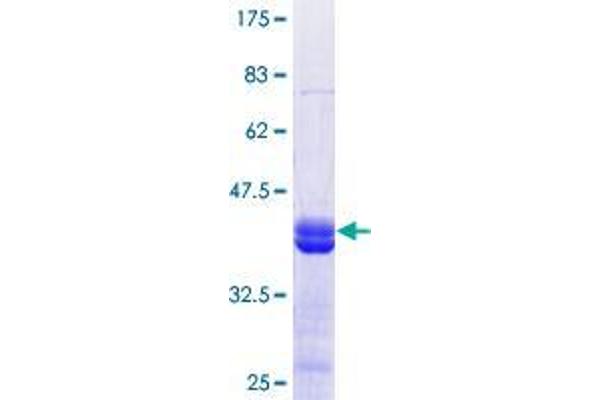 KDM2B Protein (AA 457-555) (GST tag)