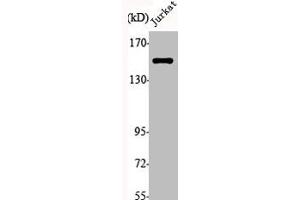 Western Blot analysis of Jurkat cells using JIP-3 Polyclonal Antibody (JIP3 antibody  (Internal Region))