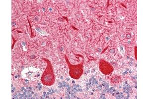 Human Brain, Cerebellum: Formalin-Fixed, Paraffin-Embedded (FFPE). (HOMER3 antibody  (AA 82-131))