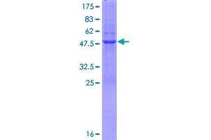 HIST1H1C Protein (AA 1-213) (GST tag)