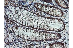 Image no. 2 for anti-Carboxypeptidase A2 (Pancreatic) (CPA2) antibody (ABIN1497598) (Carboxypeptidase A2 antibody)
