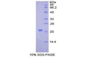 SDS-PAGE of Protein Standard from the Kit  (Highly purified E. (COL8A1 ELISA Kit)