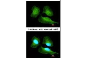 ICC/IF Image Immunofluorescence analysis of methanol-fixed HeLa, using Cullin 7, antibody at 1:200 dilution. (Cullin 7 antibody  (C-Term))