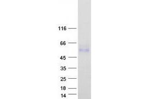 LRTM2 Protein (Transcript Variant 2) (Myc-DYKDDDDK Tag)