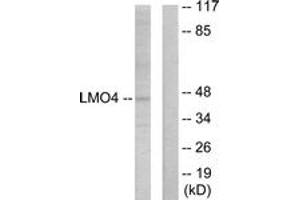 Western blot analysis of extracts from 293 cells, using LMO4 Antibody.